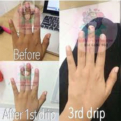Stemcells Skin Whitening Treatment