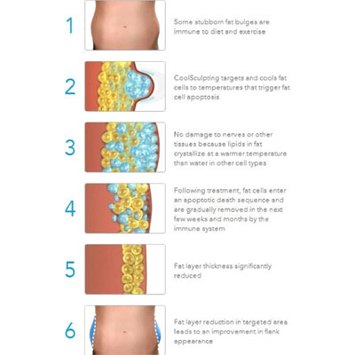 Fatloss Treatment 