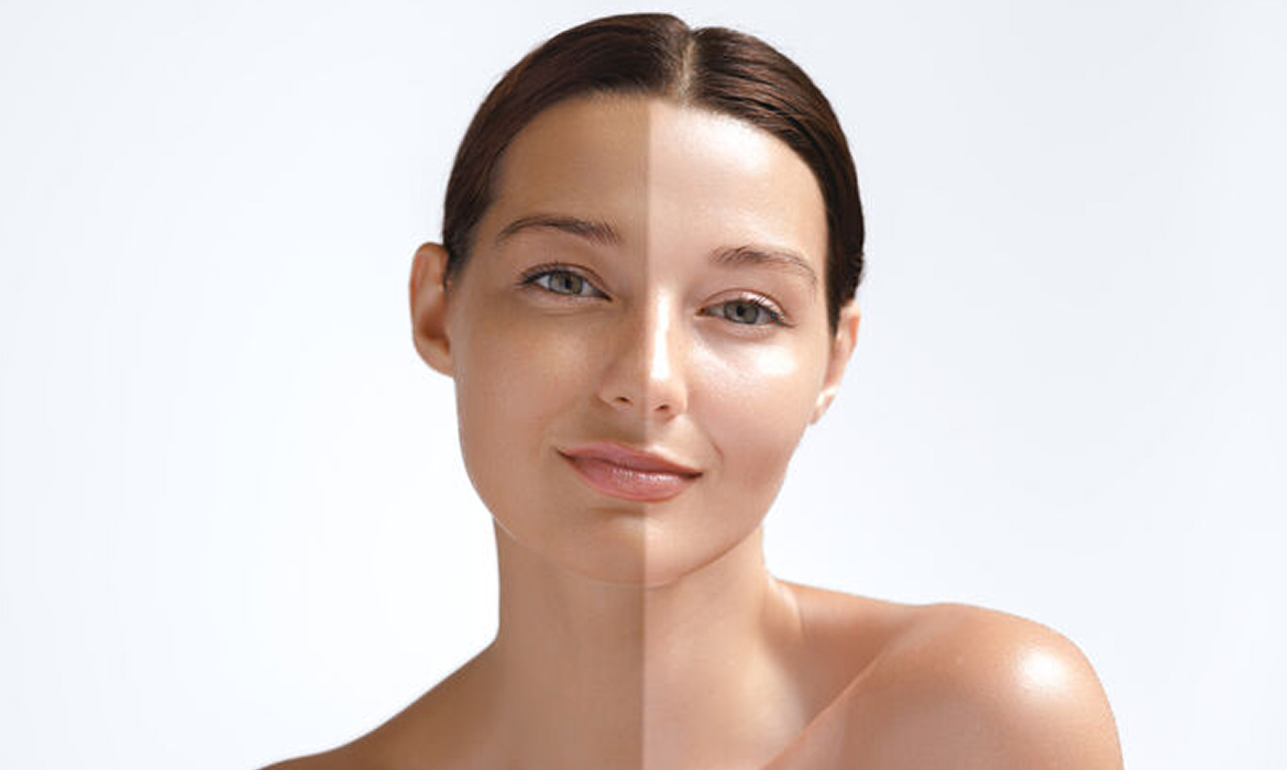 Skin Whitening
